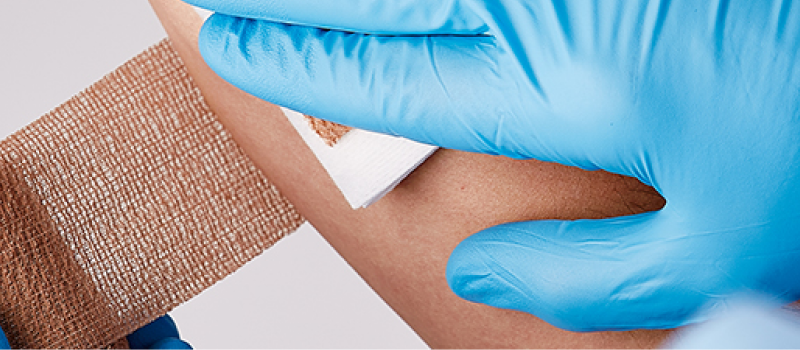 Hemostatic Agents